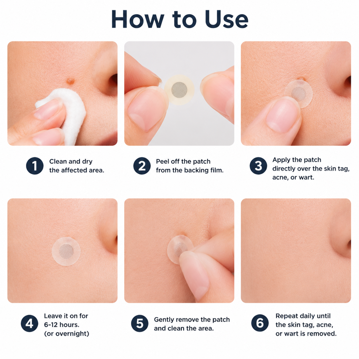ShapeOil®2-in-1 Microneedle & Hydrocolloid Patch