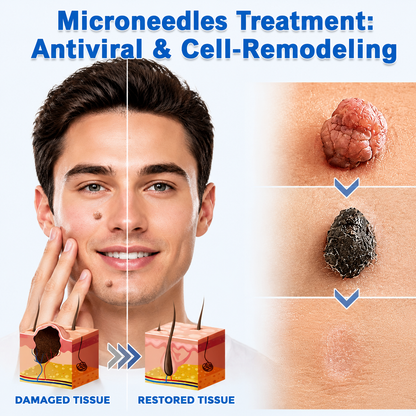 ShapeOil®2-in-1 Microneedle & Hydrocolloid Patch